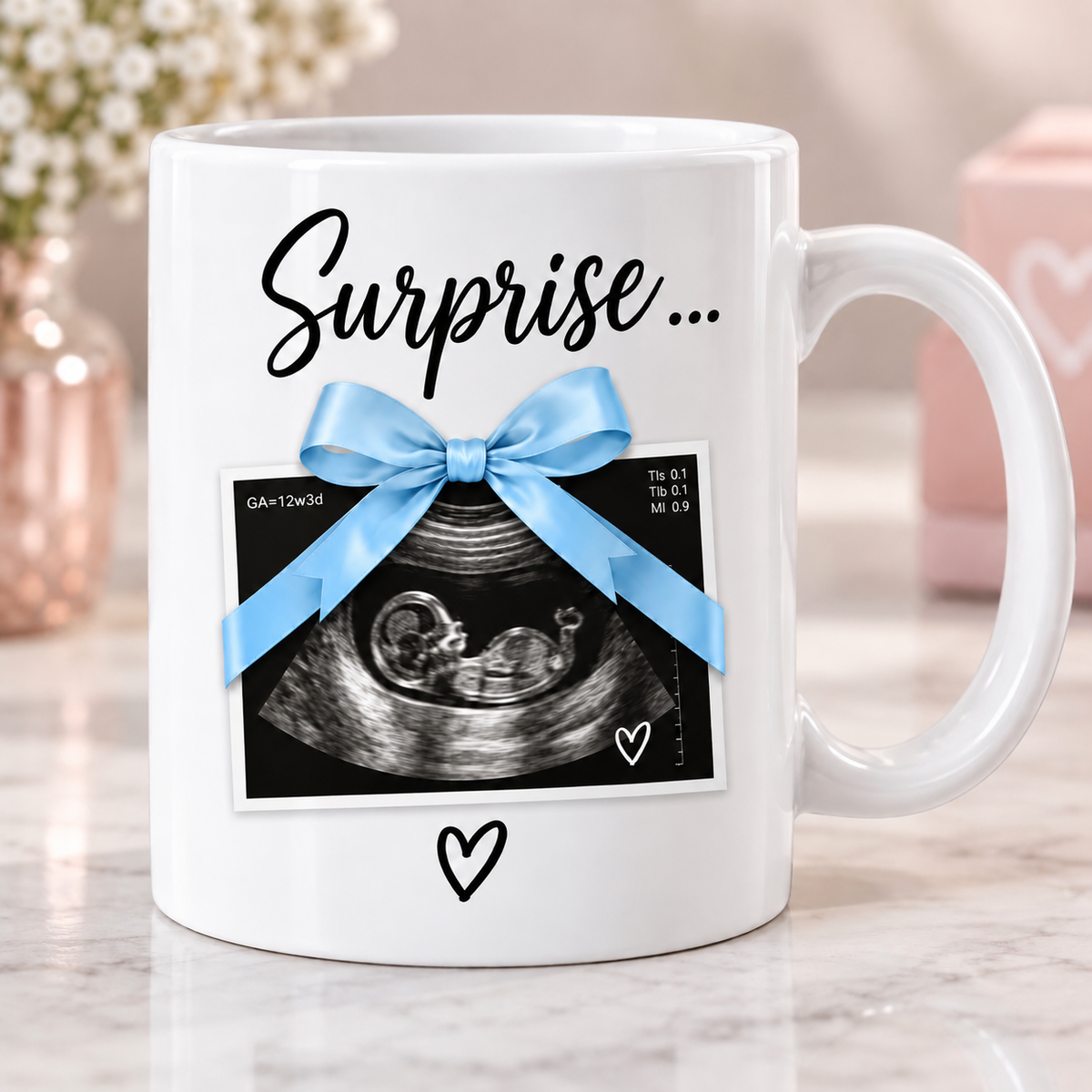 Mug Annonce Grossesse Personnalisé avec Échographie – Surprise Bébé – Cadeau Futur Papa & Grands-Parents – Nœud